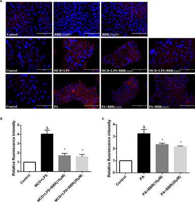 Berberine Inhibits Nod-Like Receptor Family Pyrin Domain Containing 3 Inflammasome Activation and Pyroptosis in Nonalcoholic Steatohepatitis via the ROS/TXNIP Axis